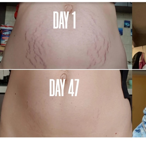 COPY - MAELYS B-FLAT BELLY FIRMING CREAM 100ML - Picture 2 of 11